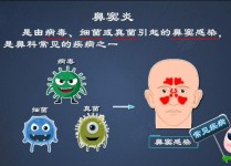 鼻子有哪些常见的疾病